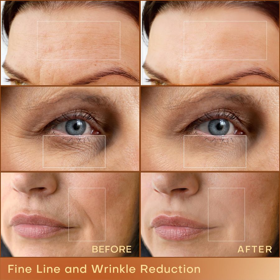 MLAY Professional RF Beauty Machine