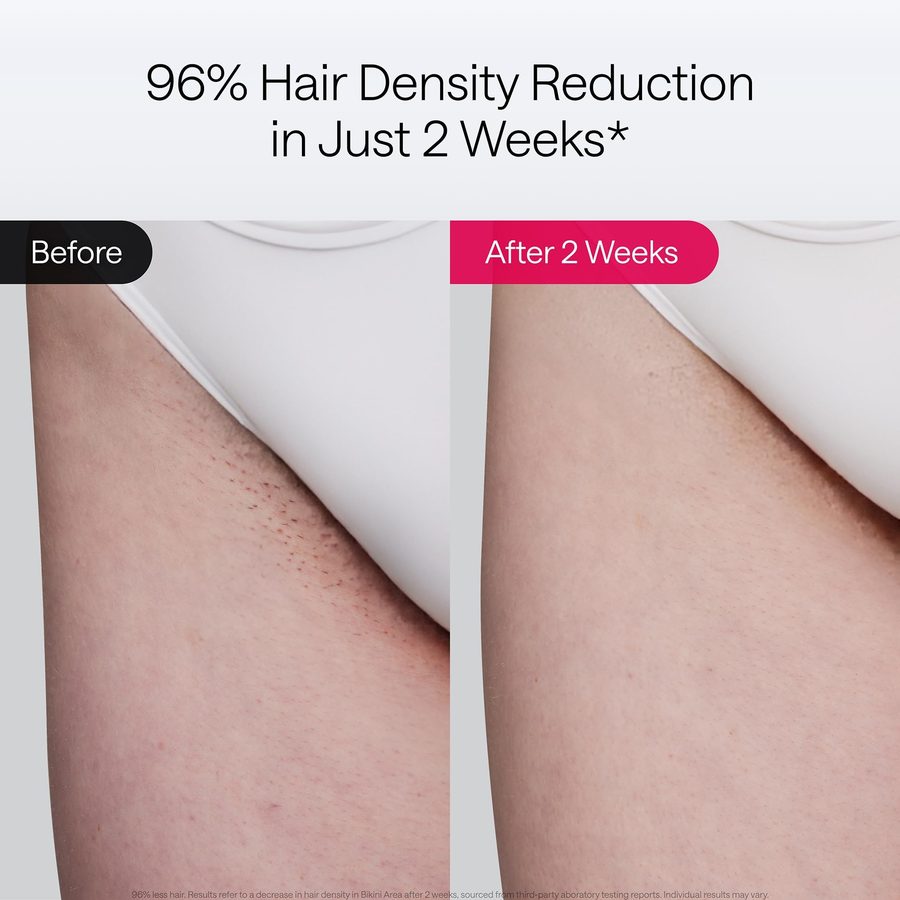 Ulike Air 10 Deluxe IPL Hair Removal Device